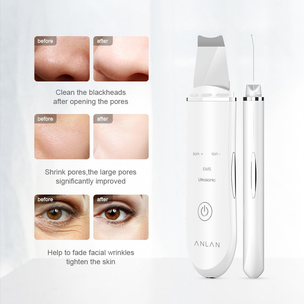 PorePerfect Ultrasonic DeepCleanser